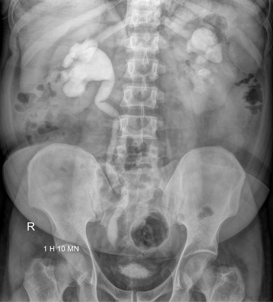 Radiology Quiz 146634 Radiopaedia Org