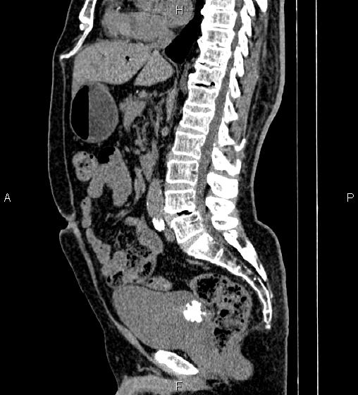 Image | Radiopaedia.org