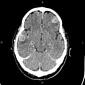 Radiology Quiz 147339 | Radiopaedia.org