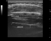 Viewing Playlist Msk Us Radiopaedia Org