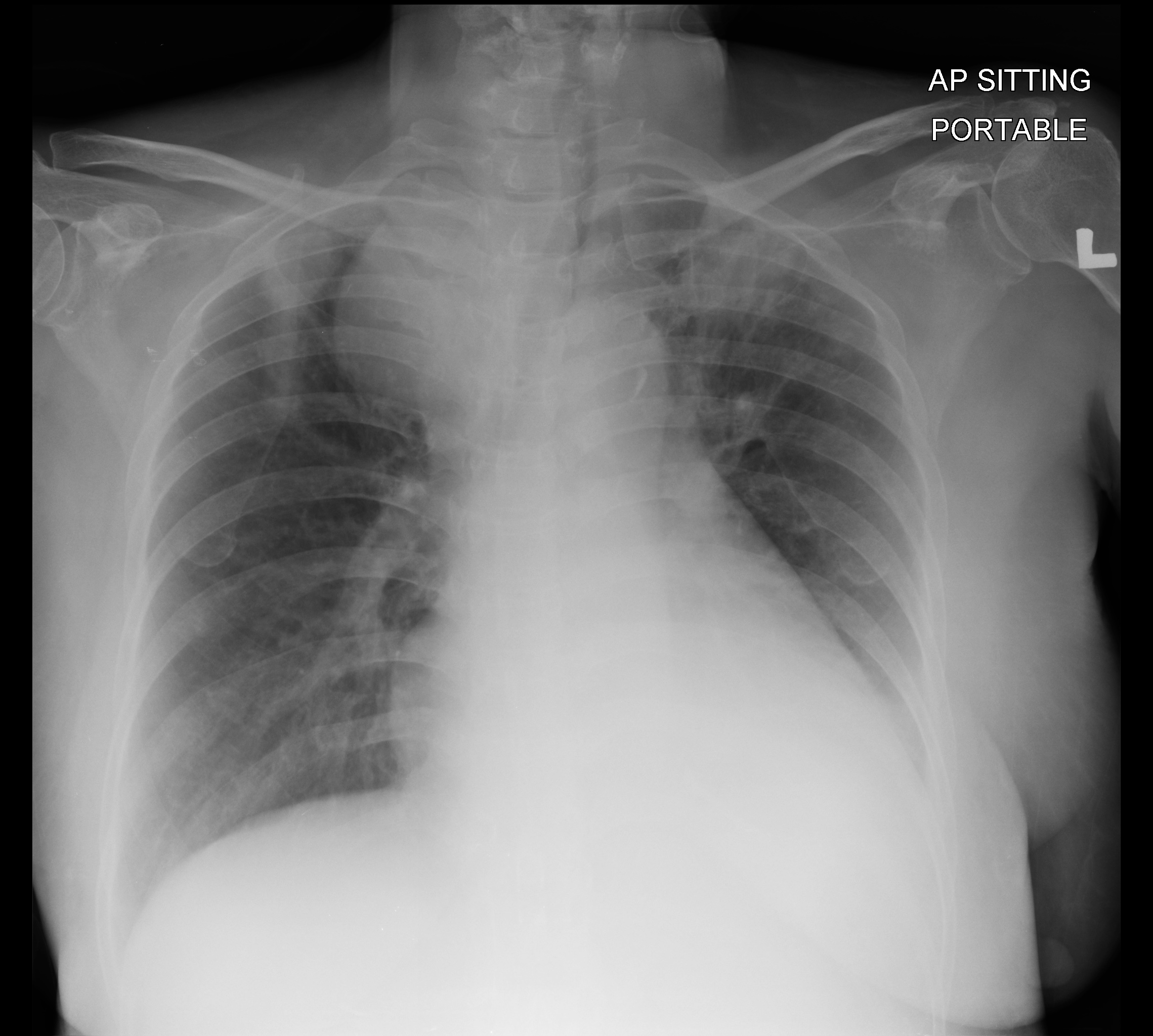 Radiology Quiz 148734 | Radiopaedia.org