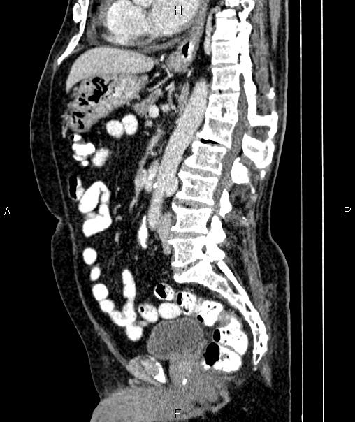 Image | Radiopaedia.org