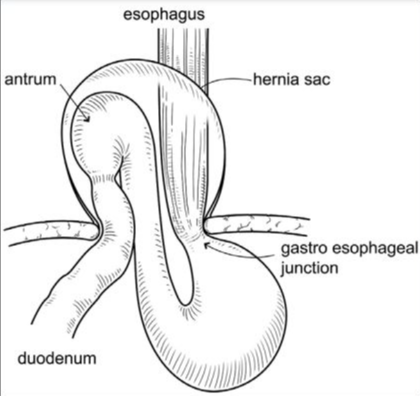 Image | Radiopaedia.org