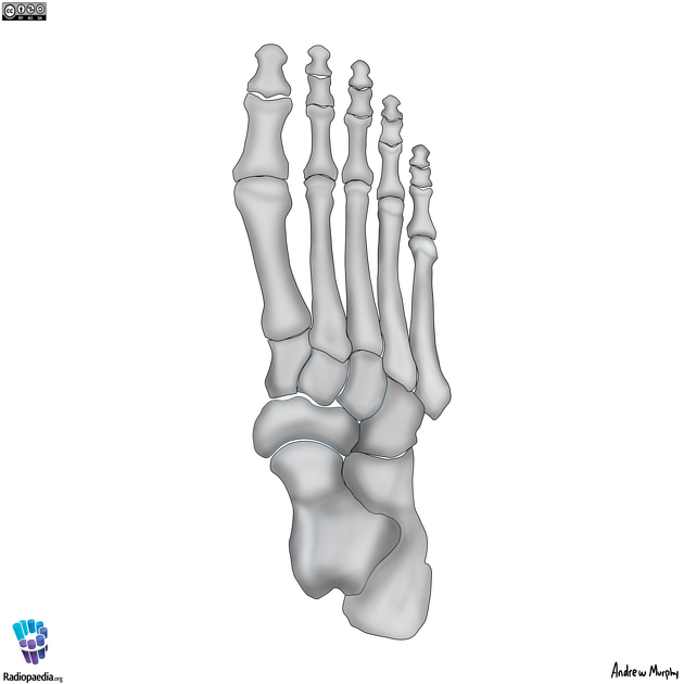 Chopart and Lisfranc joints illustrations Radiology Case