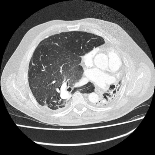 Radiology Quiz 151988 | Radiopaedia.org