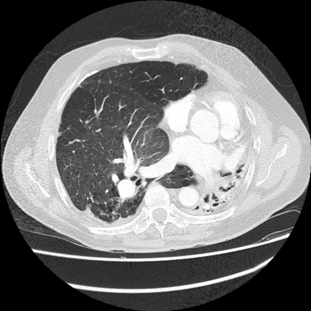 Radiology Quiz 151988 | Radiopaedia.org