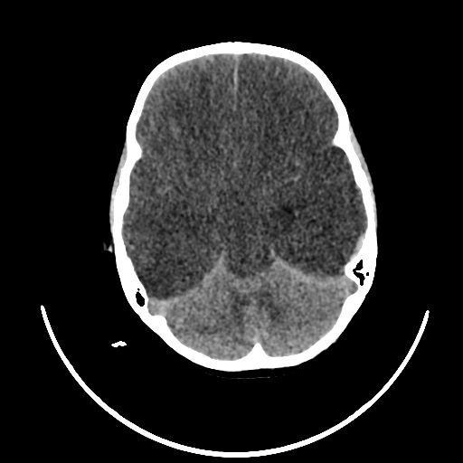 Image Radiopaedia Org