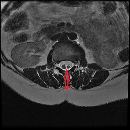 Image | Radiopaedia.org