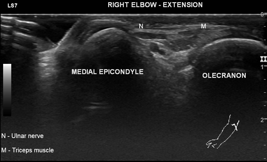 Image | Radiopaedia.org