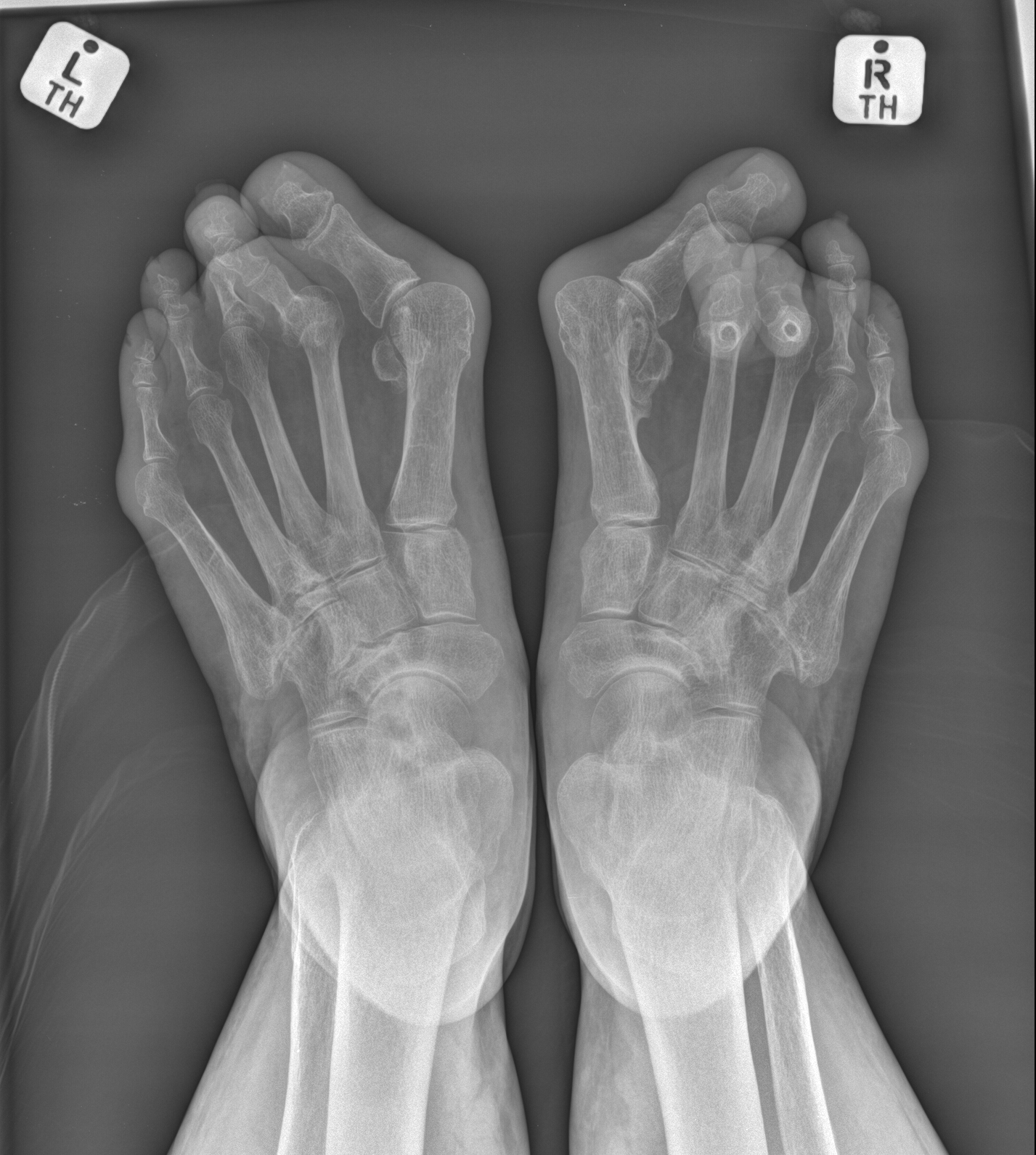 Radiology Quiz 152860 | Radiopaedia.org