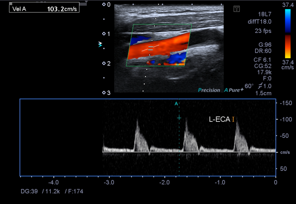 Image | Radiopaedia.org