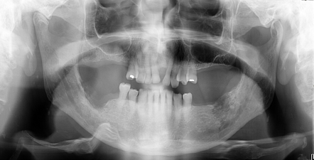 Radiology Quiz 153823 | Radiopaedia.org