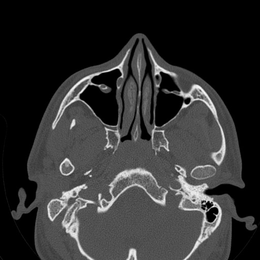 Image | Radiopaedia.org