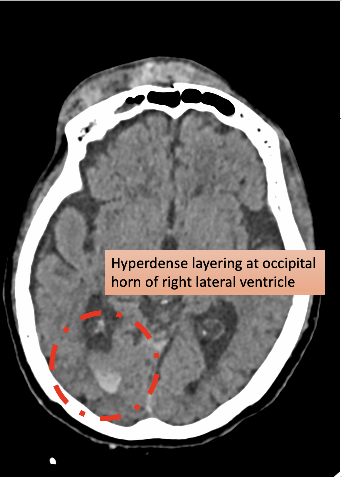 Image | Radiopaedia.org