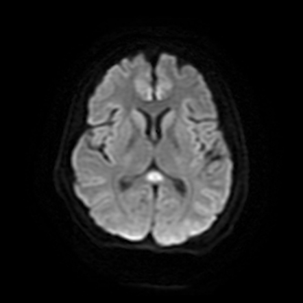 Playlist 'Brain. corpus callosum' by Dr Mohamed Saber