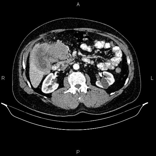 Image | Radiopaedia.org