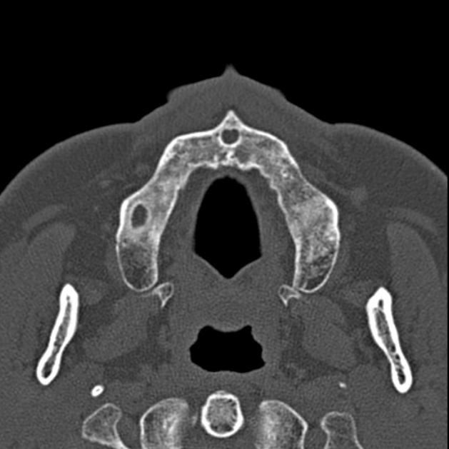 Radiology Quiz 27879 | Radiopaedia.org