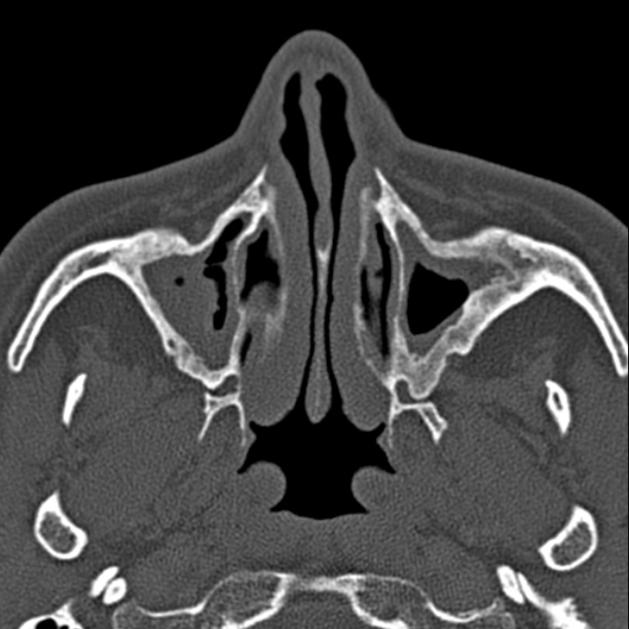 Radiology Quiz 27879 | Radiopaedia.org