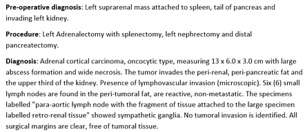 Adrenal cortical carcinoma | Image | Radiopaedia.org