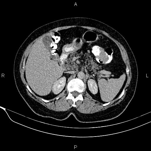 Image | Radiopaedia.org