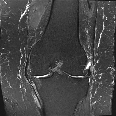 Radiology Quiz 157901 | Radiopaedia.org