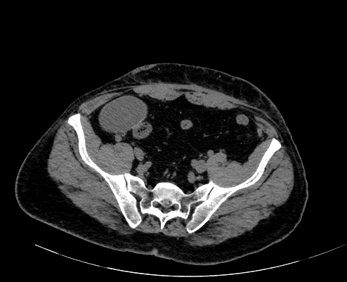 Radiopaedia Quiz