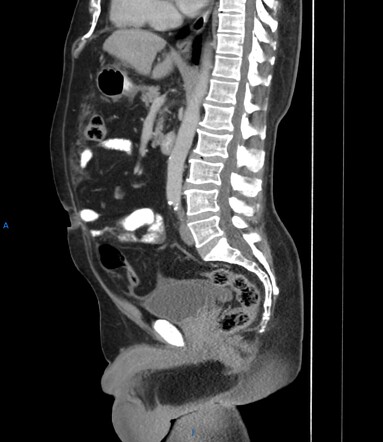 Images Radiopaedia Org