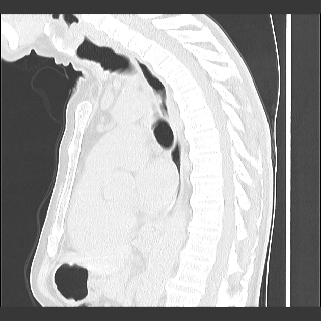 Images | Radiopaedia.org