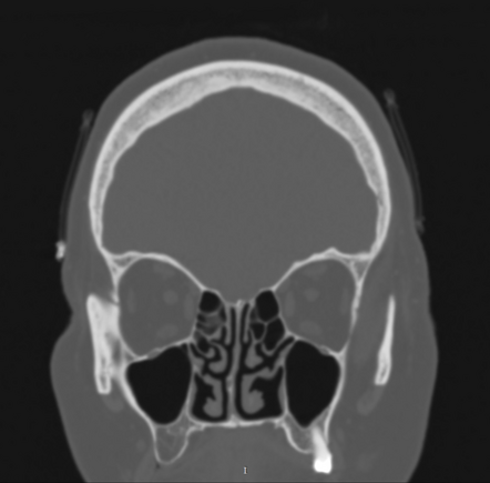 Images | Radiopaedia.org