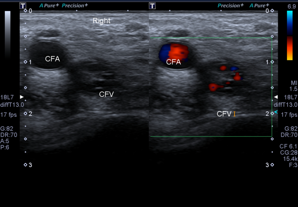 Image Radiopaedia Org