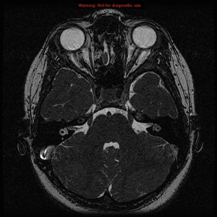 Image | Radiopaedia.org