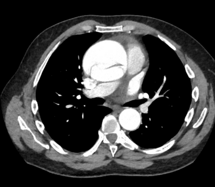 Radiology Quiz 159663 | Radiopaedia.org