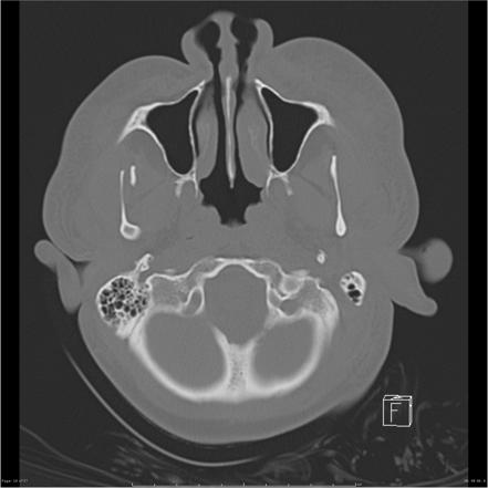 Image | Radiopaedia.org