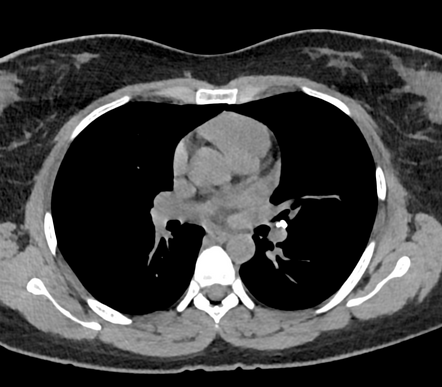 Radiology Quiz 160495 | Radiopaedia.org