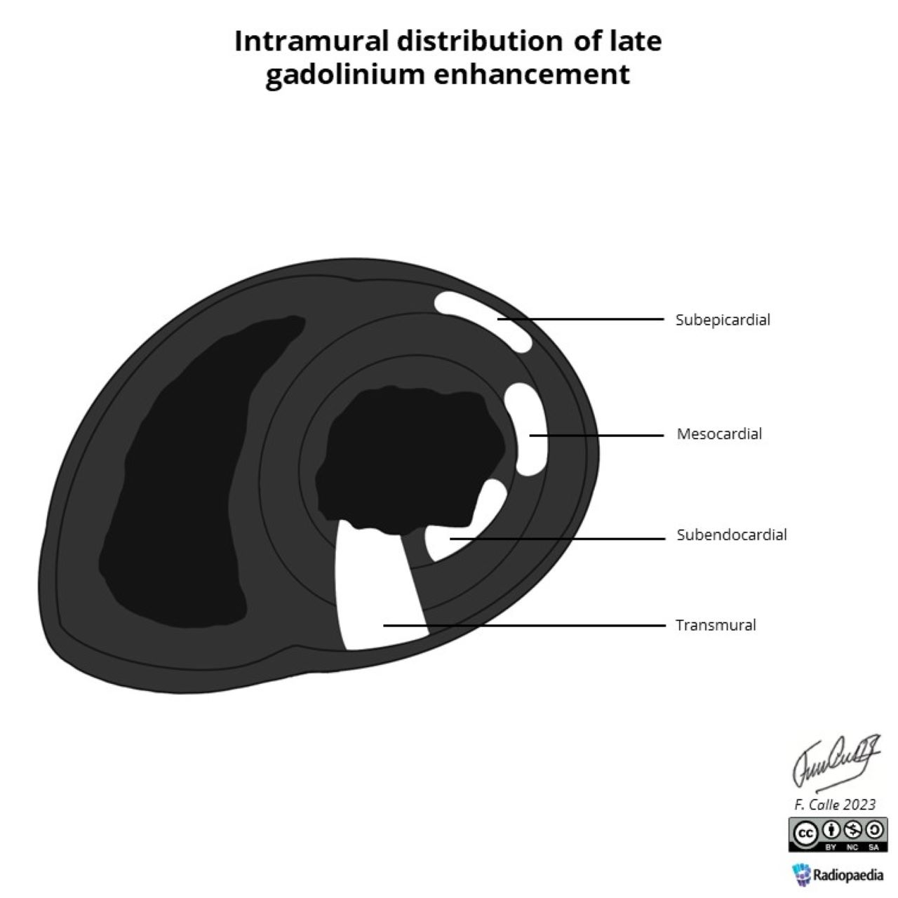 image-radiopaedia