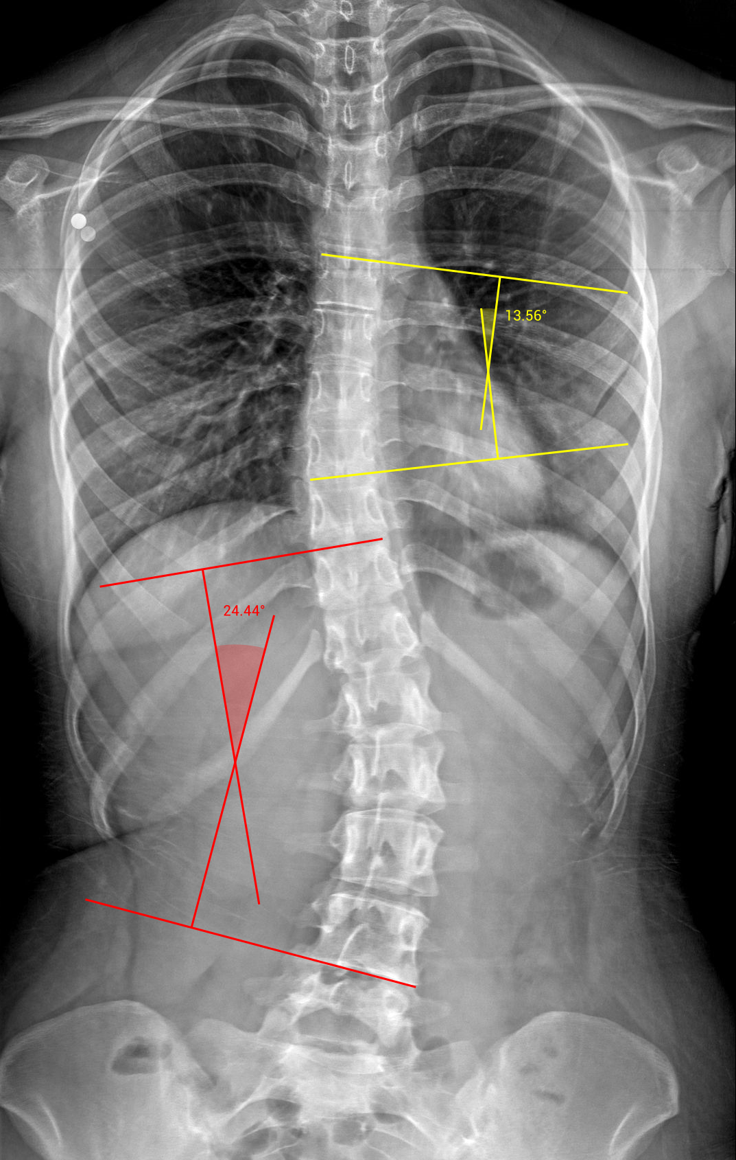 Image Radiopaedia Org