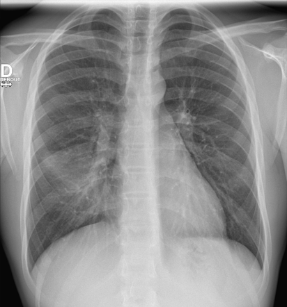 Radiology Quiz 161356 | Radiopaedia.org