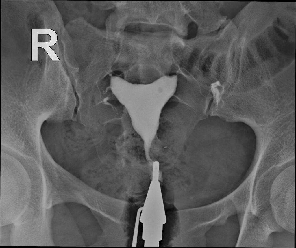 Radiology Quiz 161506 Radiopaedia