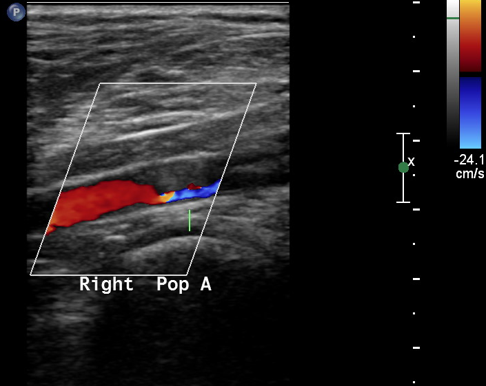 Image | Radiopaedia.org