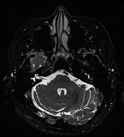 Image | Radiopaedia.org