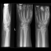 Viewing playlist: Diagnostic Imaging III-Upper Extremity Trauma ...