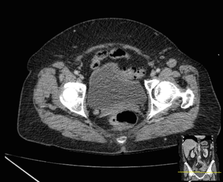 Radiology Quiz 28066 | Radiopaedia.org