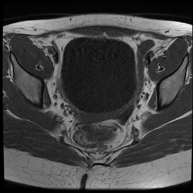 Images | Radiopaedia.org