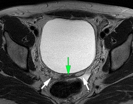 Images | Radiopaedia.org