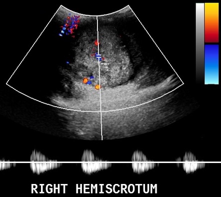 Image | Radiopaedia.org