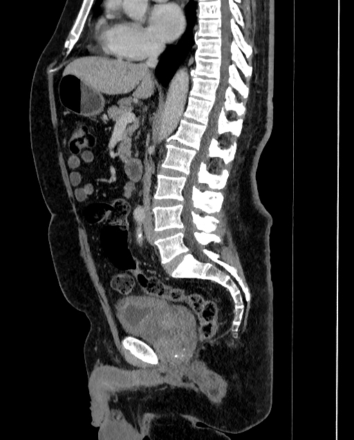 Image | Radiopaedia.org