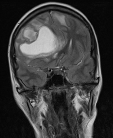 Radiology Quiz 164146 | Radiopaedia.org