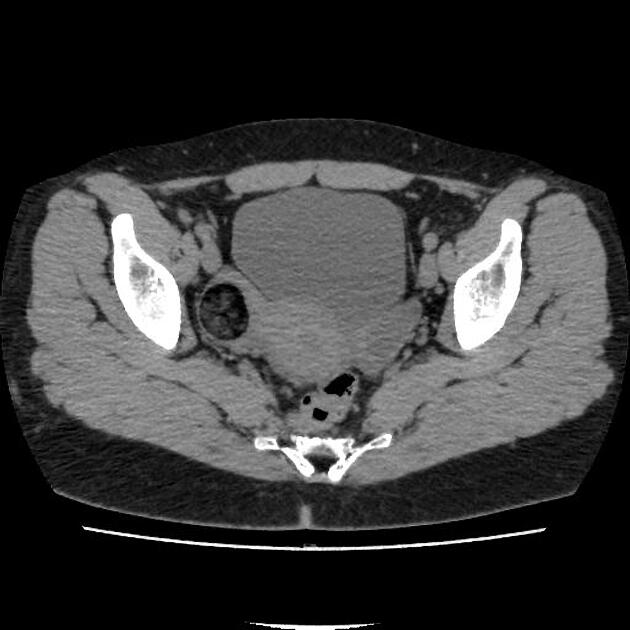 Radiology Quiz 164966 Radiopaedia