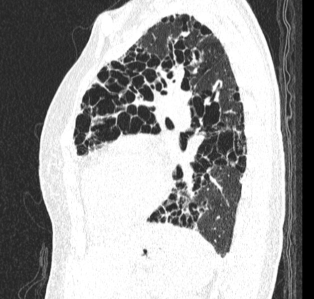 Images | Radiopaedia.org