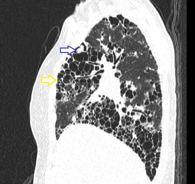 Images | Radiopaedia.org